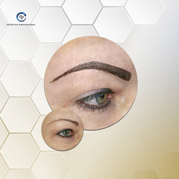 EP ESTÉTICA PROFESIONAL